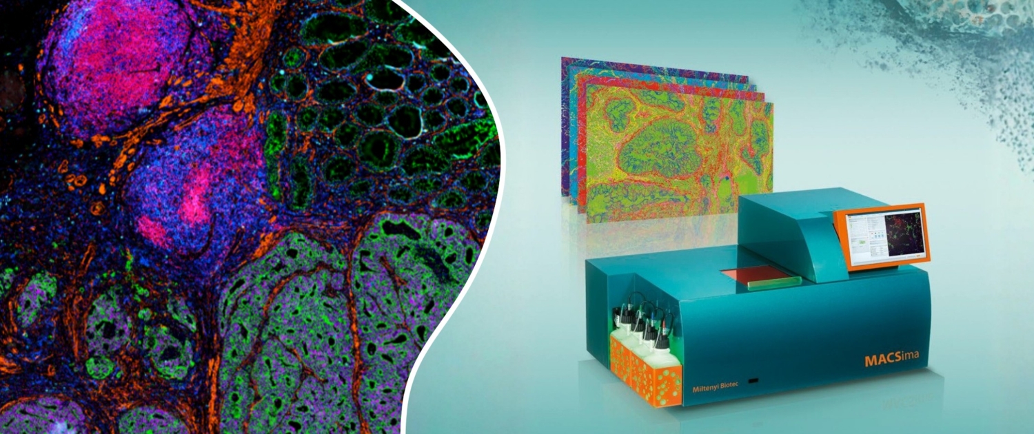 Final Version - MACSima Banner